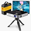 KODAK Luma 150 Complete Kit - Wireless Mini Pocket DLP Projector with Case, Tripod, 60” Screen, Rechargeable Battery, Built-in Speaker, HDMI, USB