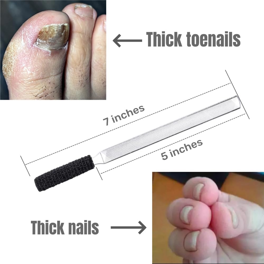 IDOU Toe Nail Files for Thick Nails,Stainless Steel 4 Sides 7 inch Length,Nail Files for Men Seniors & Dogs