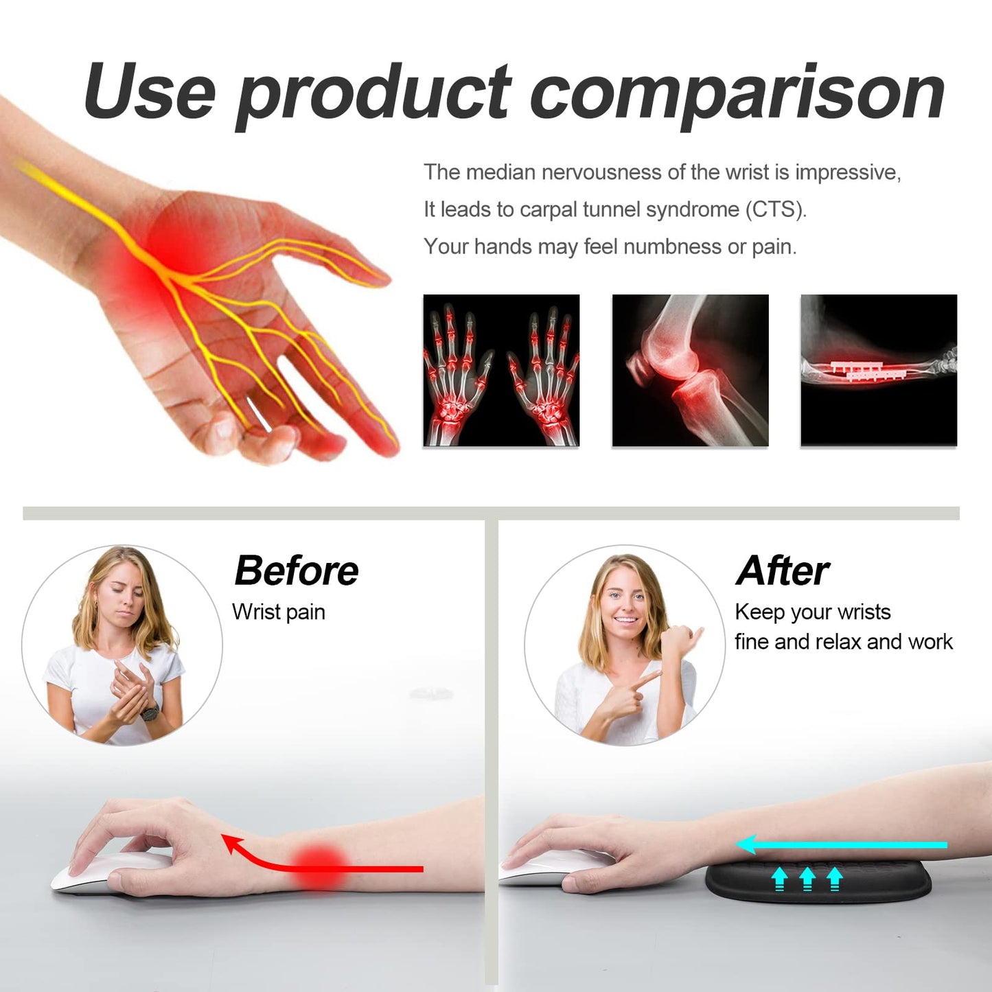 Vaydeer Cloud Elbow Pad, Desk Arm Rest Support, Soft Memory Foam Wrist Rest, Ergonomic Cushion Padding, Carpal Tunnel Pain Relief Gel Mouse Pillow