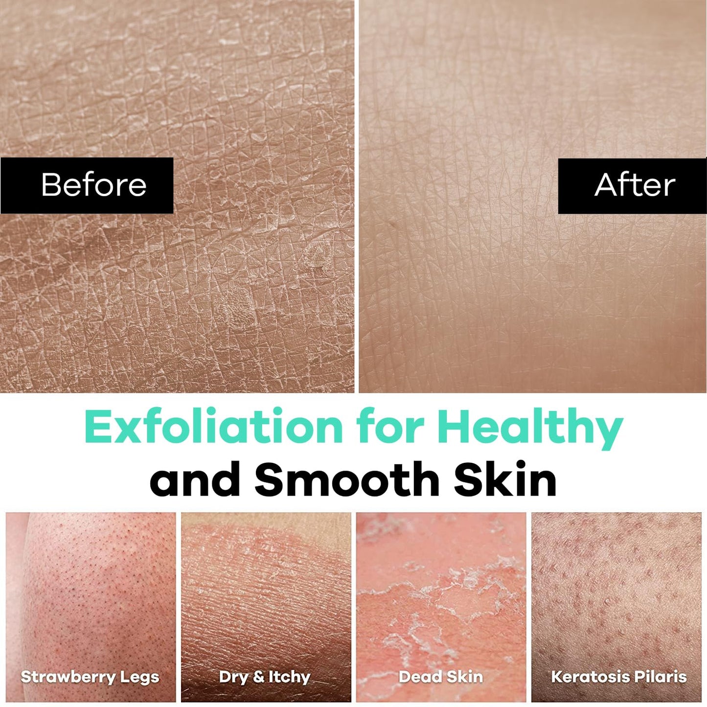 Dermasuri Deep Exfoliating Glove, Korean Body Scrubber Mitt for Dead Skin Removal, Polishing & Keratosis Pilaris Treatment, Shower Skincare, 1-Pack